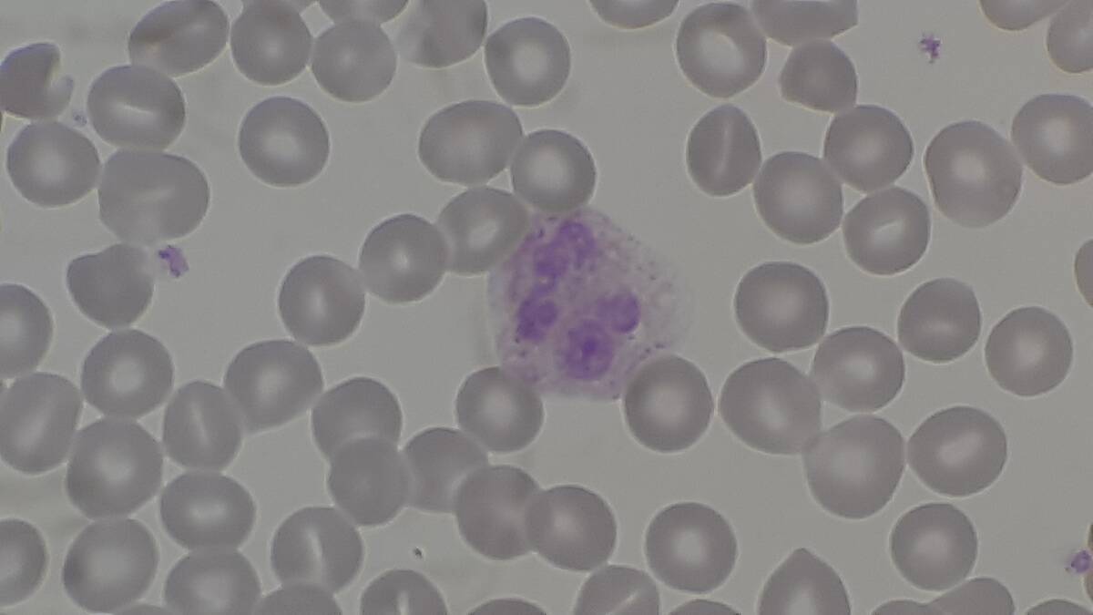 Red_blood_cells_(RBCs),_platelets_and_white_blood_cells_or_leukocyte_(neutrophil)_on_PBS