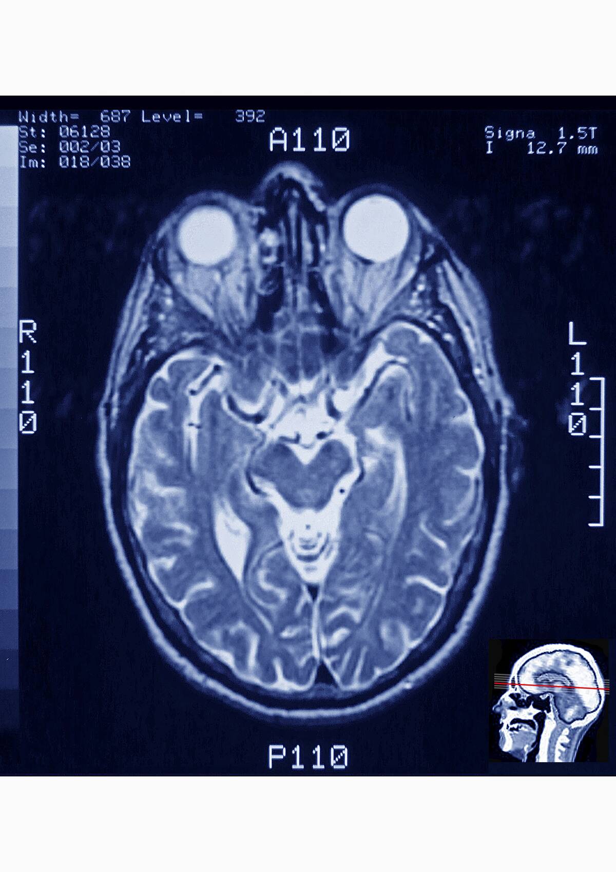 Head, Mri