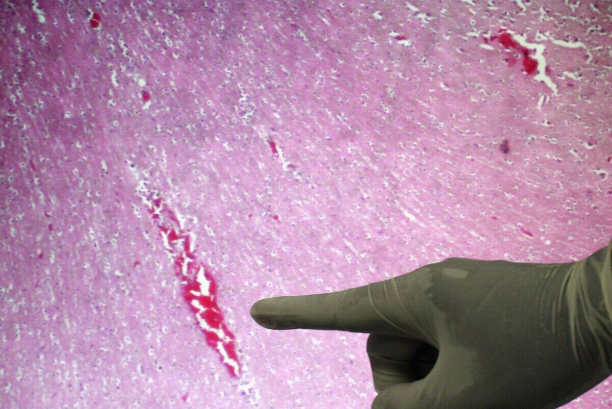 Indonesian University Tests For Bird Flu Mutations