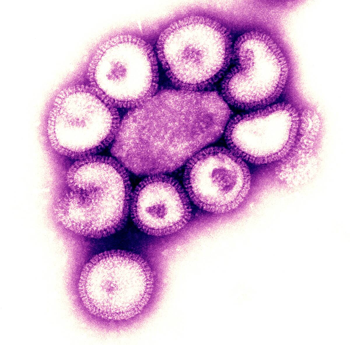 Influenza Virus, Tem