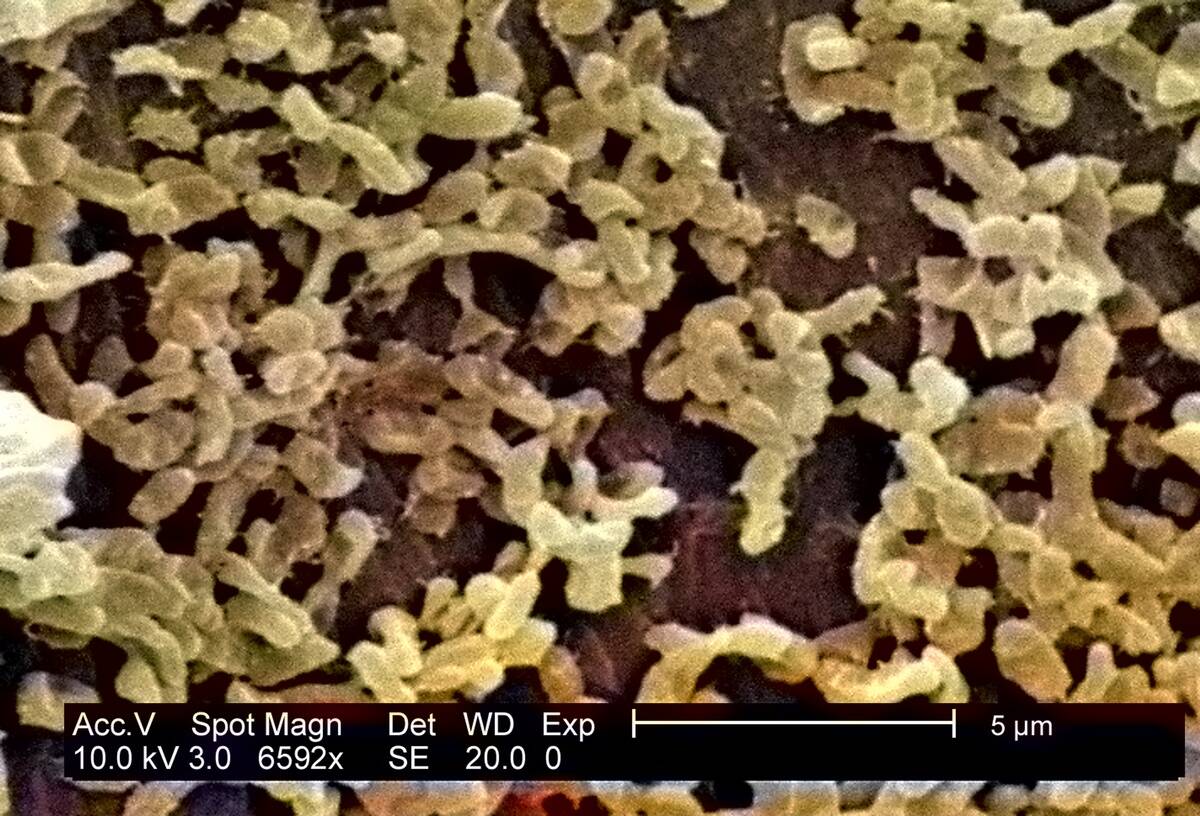 P.Mirabilis (ATCC 29906) Biofilm (Colorized)