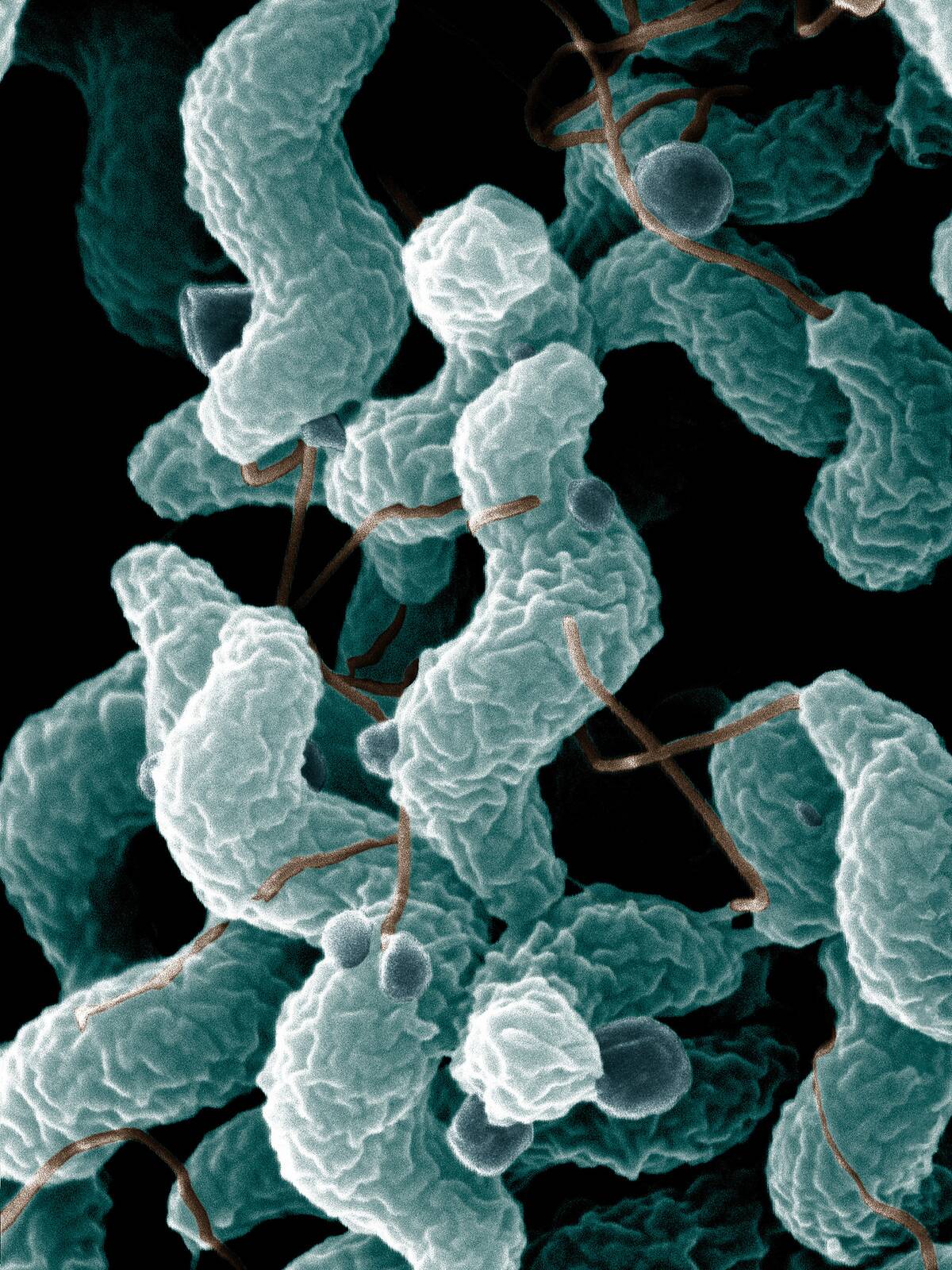 ARS_Campylobacter_jejuni