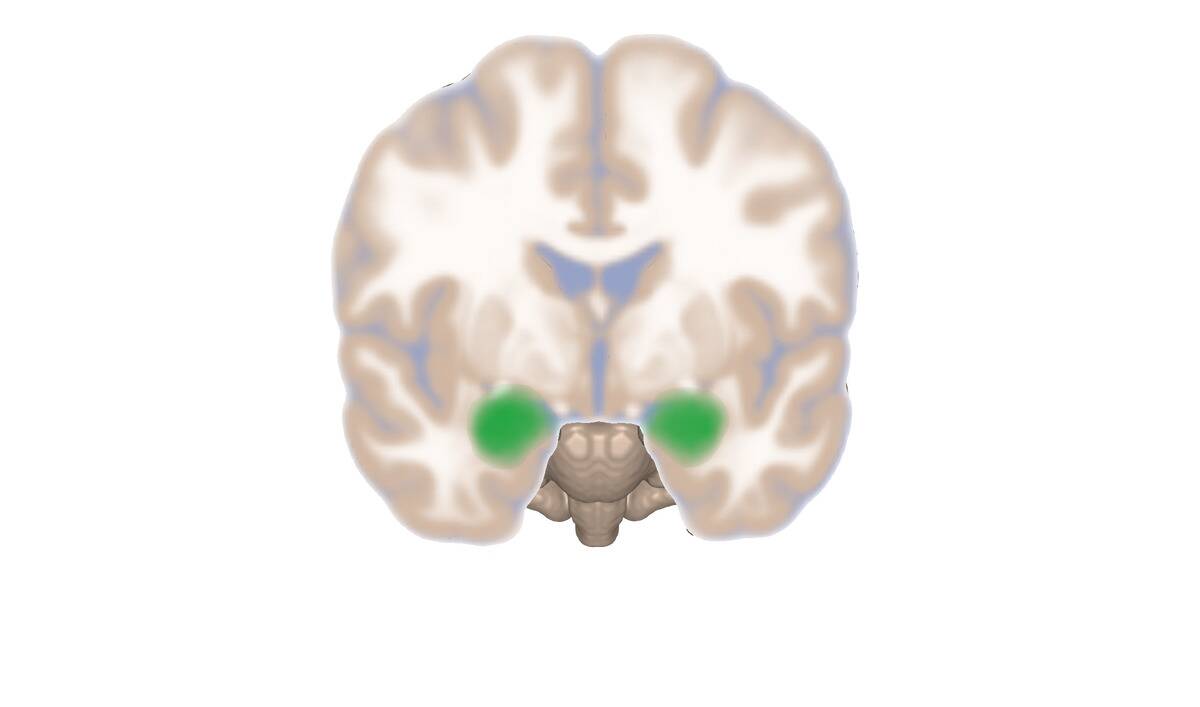 Amygdala_frontal_slice