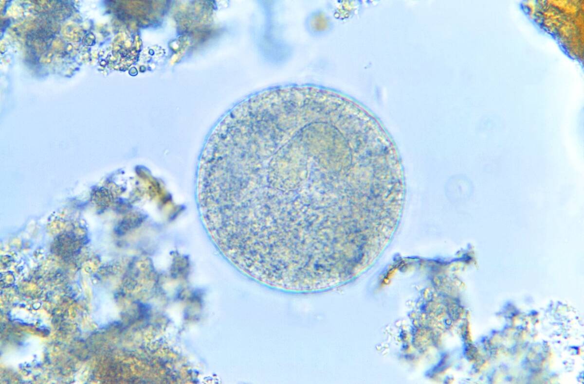 Balantidium Coli Cyst Photomicrograph