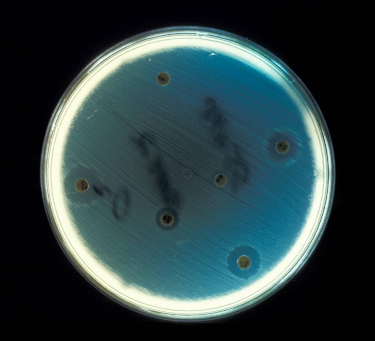 Enterococcus Faecalis