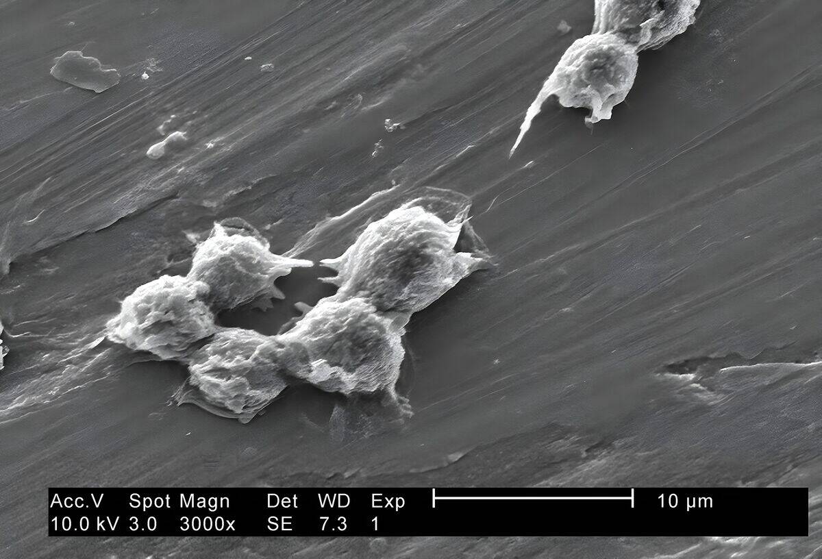 Hartmannella vermiformis