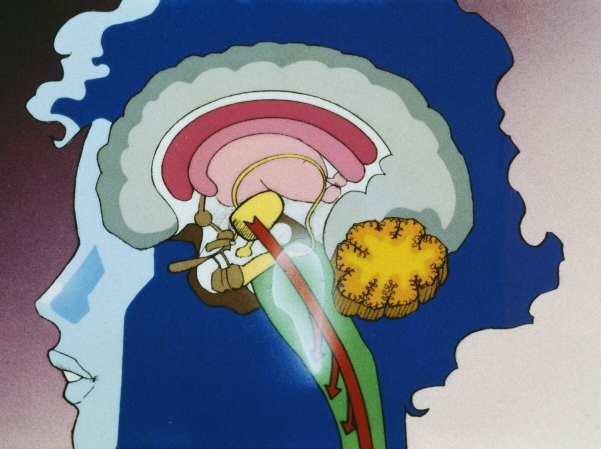 Heart rate variability caused by emotional stress...