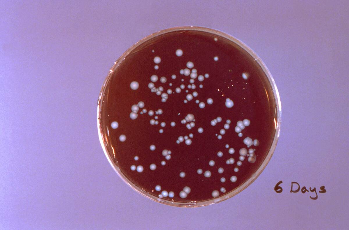 Legionella Pneumophila