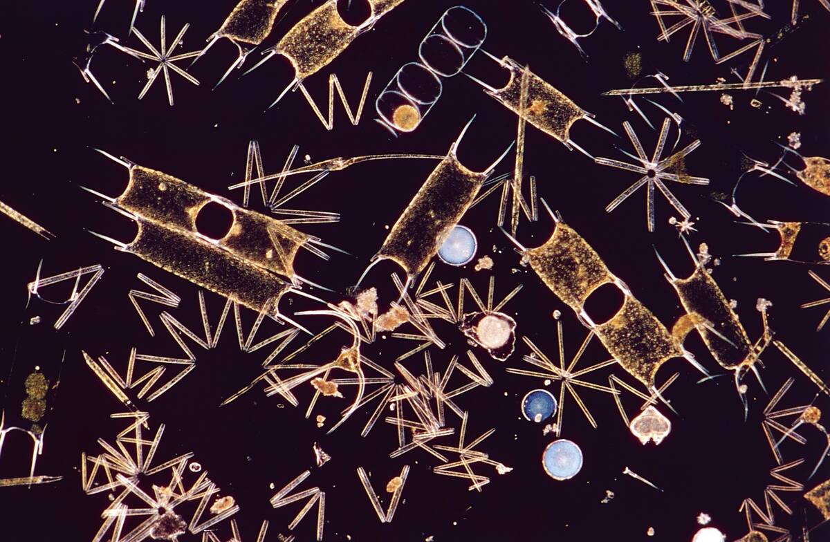 Microphotograph of thalassiothrix frauenfeldii...
