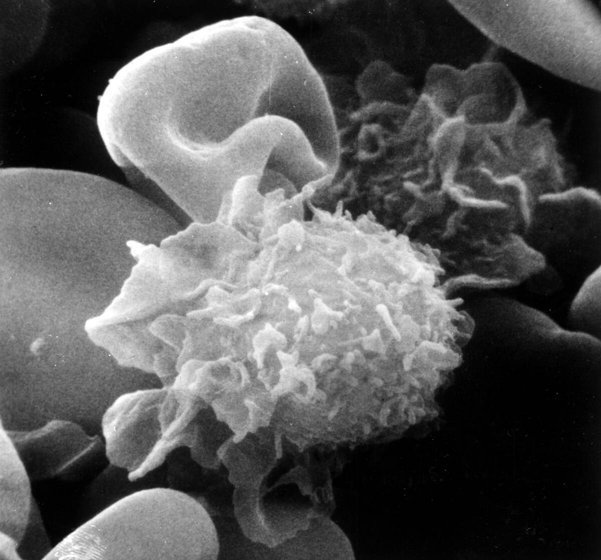 Microscope Image Of Hairy Cells