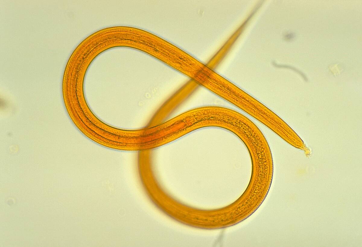 Strongyloides Filariform Larva