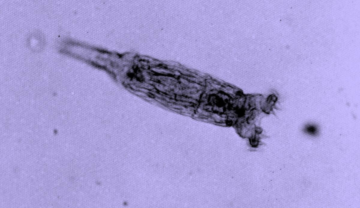Bdelloid_rotifer_(3403951330)