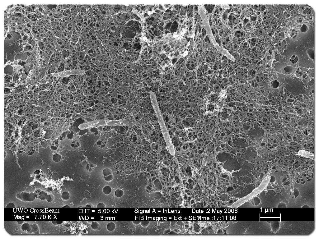 Desulforudis_audaxviator