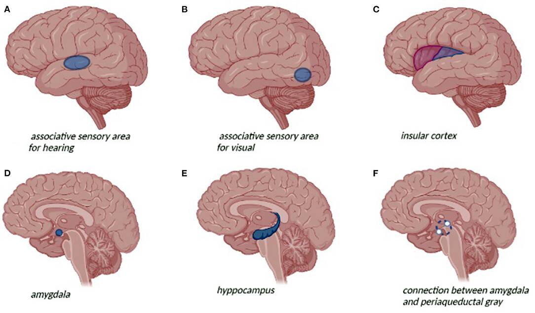 Temporal_lobe_epilepsy