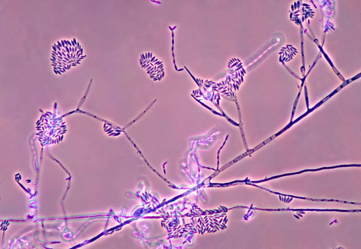 Fusarium Verticillioides
