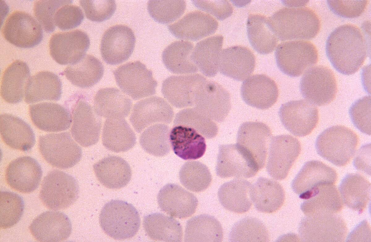 Plasmodium Malariae