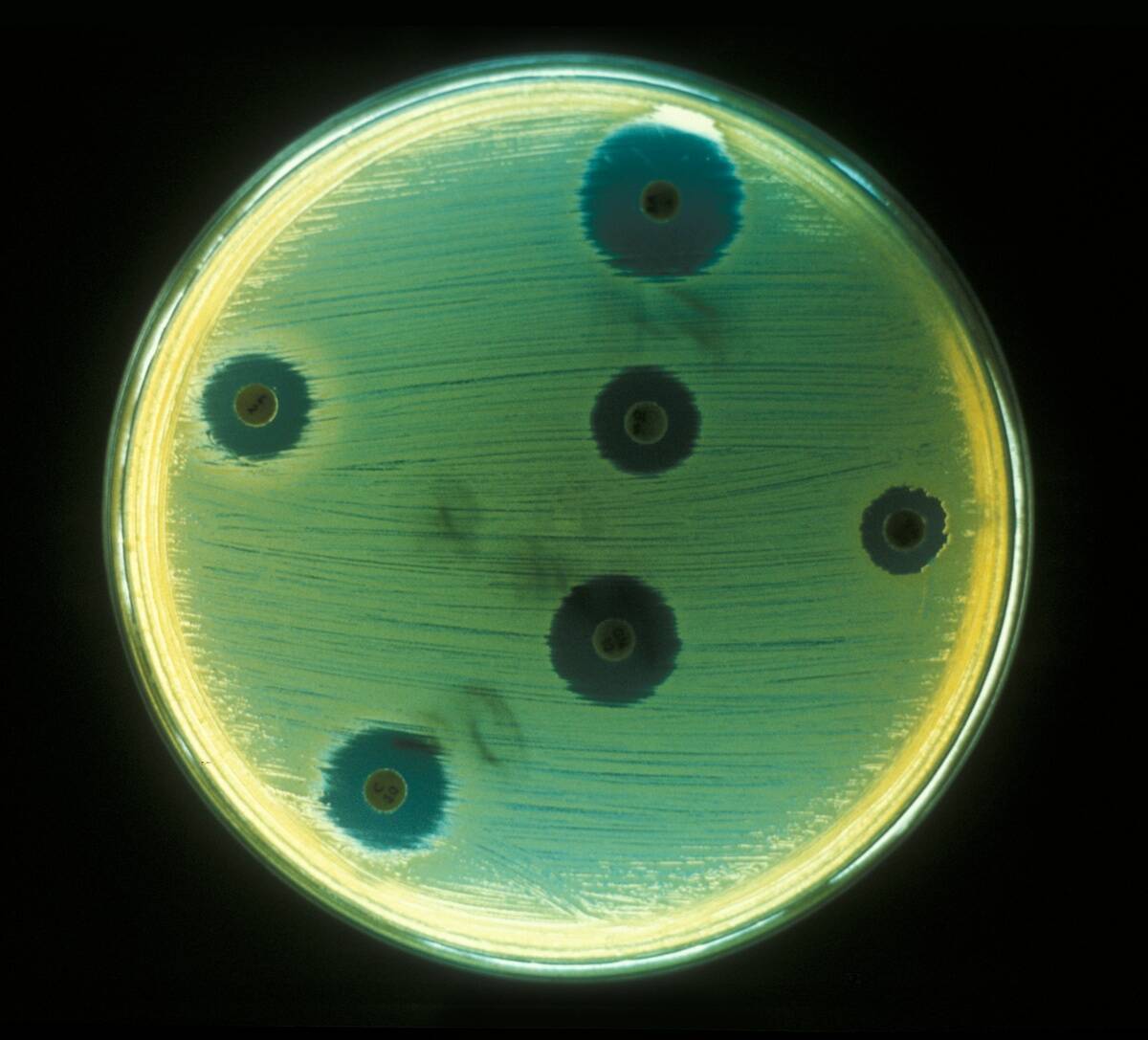 Staphylococcus Aureus