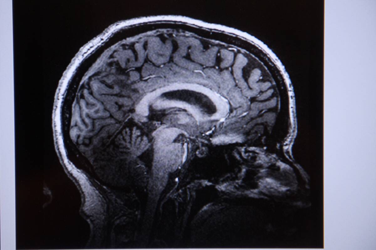 Center for Brain Health at the University Medical Center Magdeburg